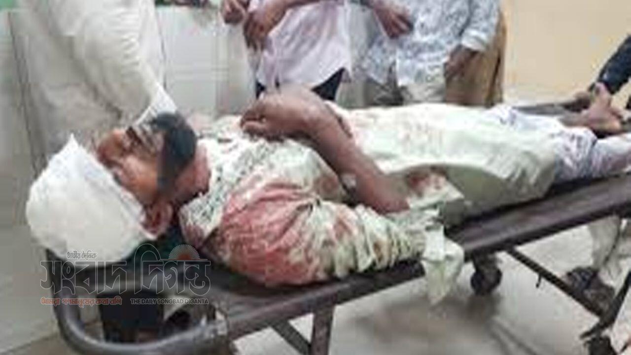 সন্ত্রাসী হামলায় জামায়াত নেতা গুরুতর আহত 
