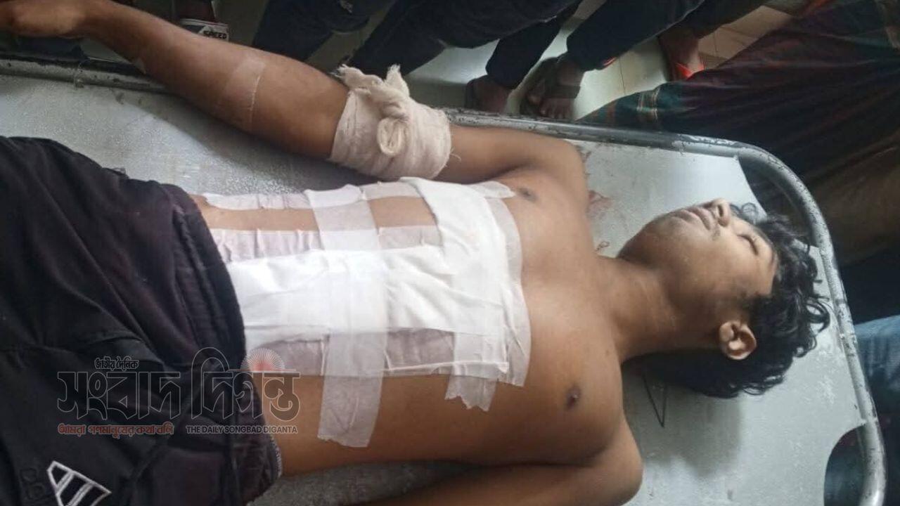 বগুড়ায় ধারালো চাকুর কারুকার্য দিনে ও রাতে বৃদ্ধি পাচ্ছে! 