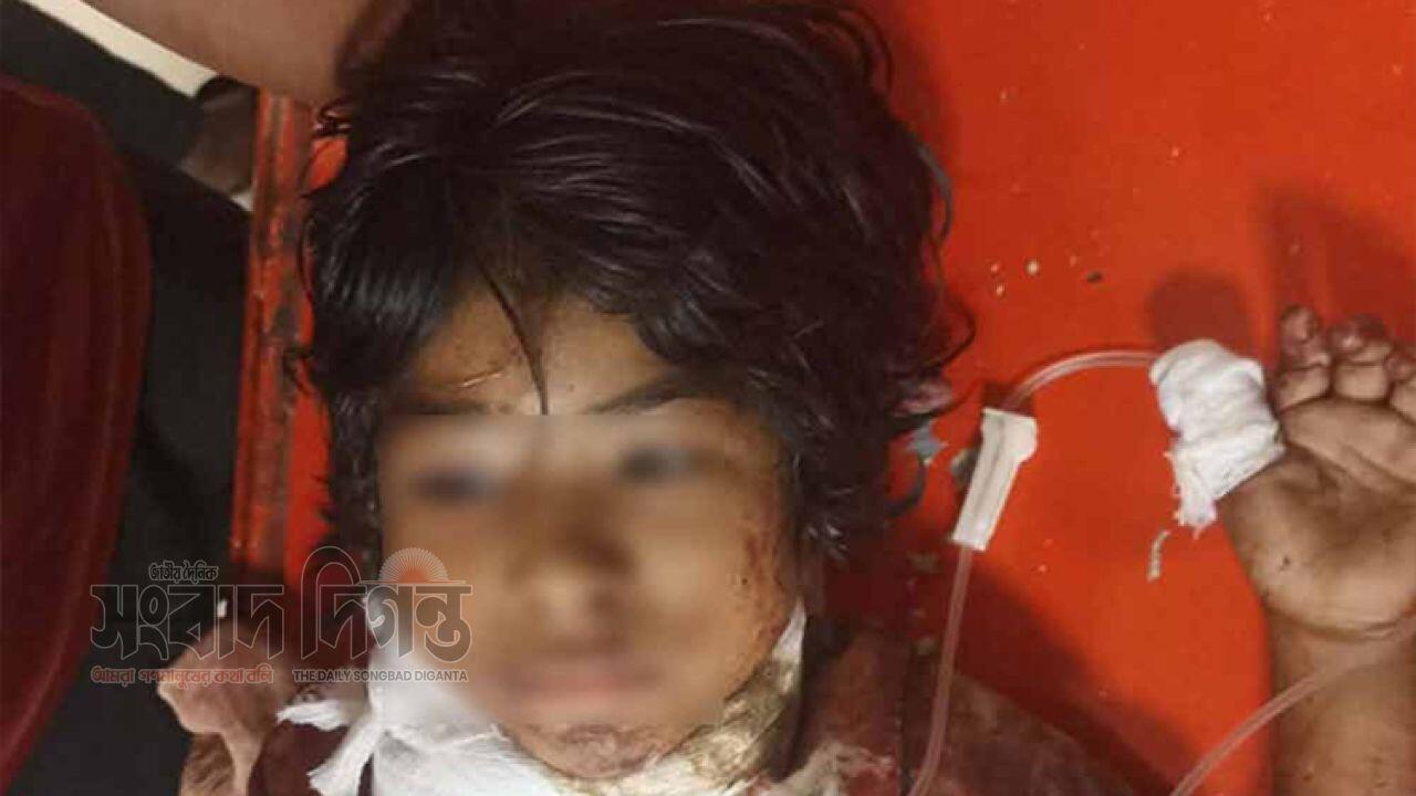 সীতাকুণ্ড গলাকাটা অবস্থায় উদ্ধার হওয়া শিশুর মৃত্যু
