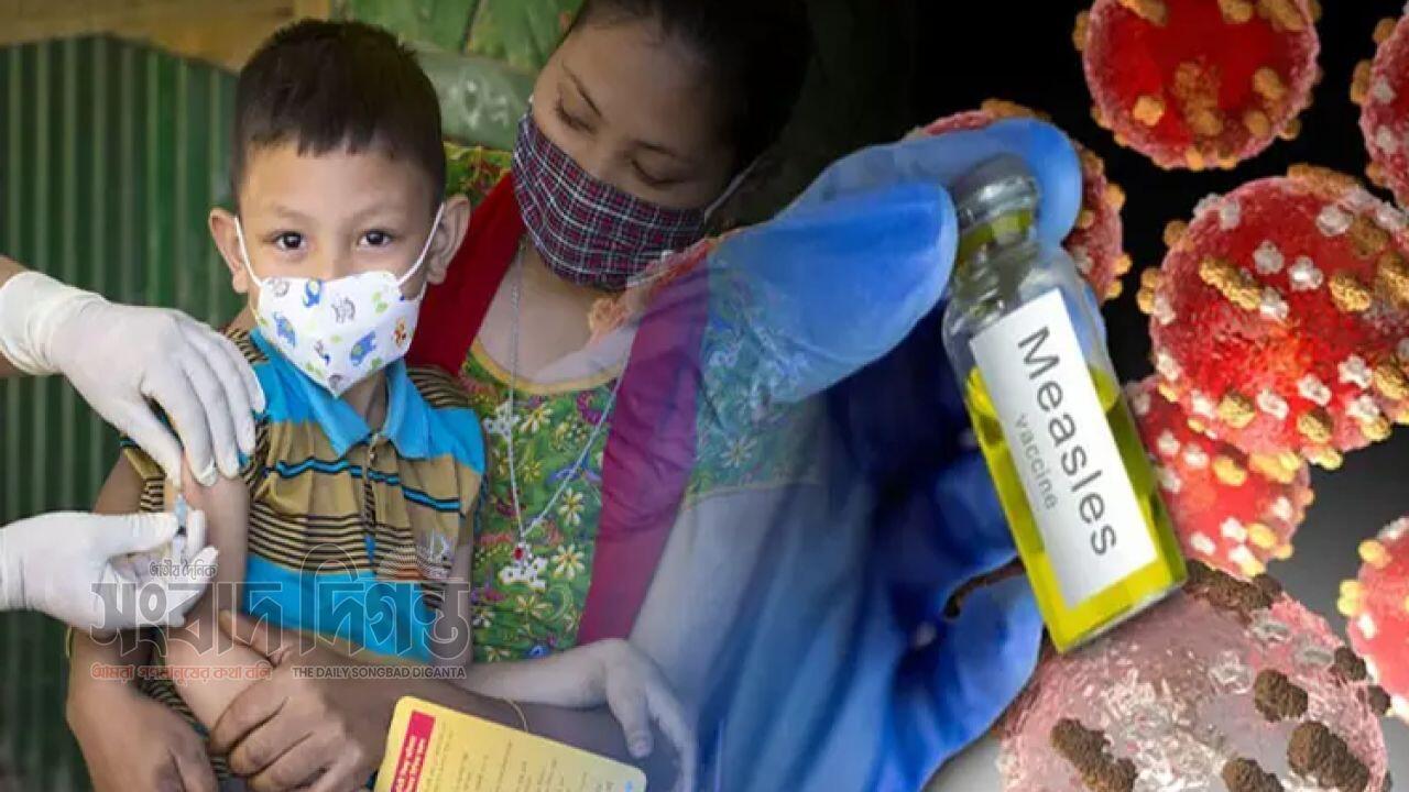 ঝুঁকিপূর্ণ ৩০ উপজেলায় হামের বিশেষ টিকা অভিযান শুরু লক্ষ্যমাত্রার ১৯% শিশু টিকা পেয়েছে 