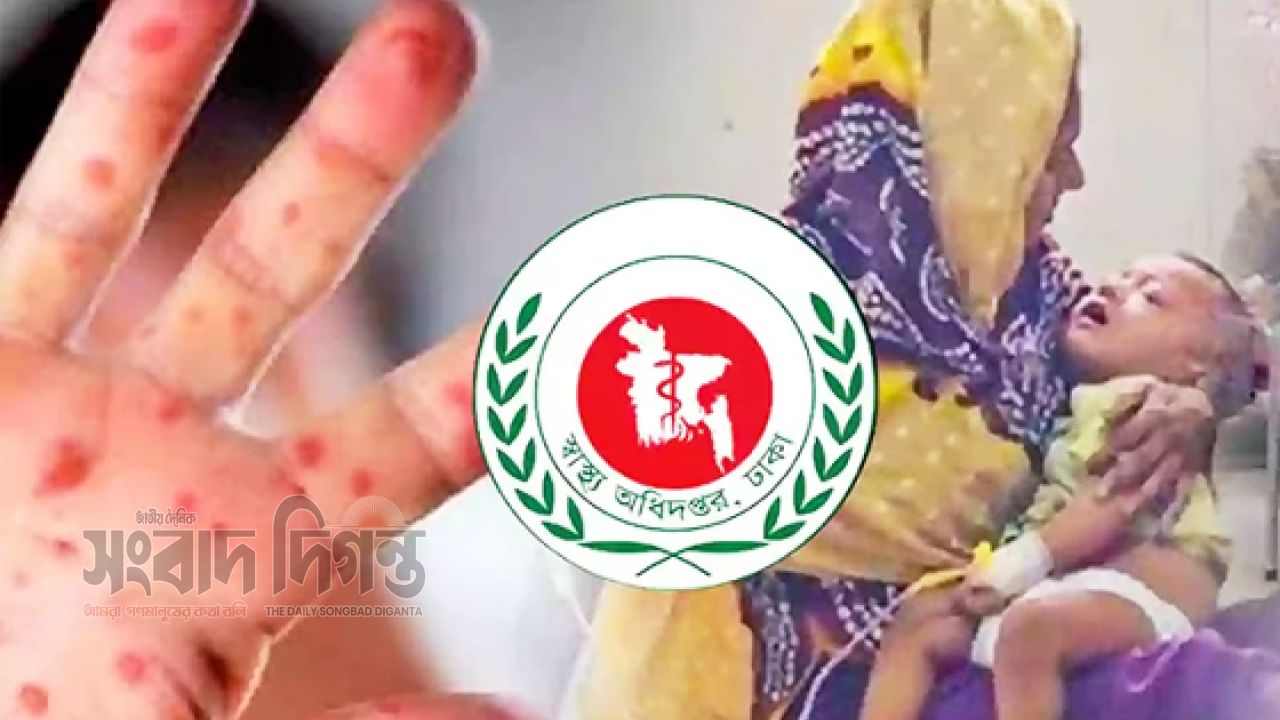 দেশে হামে নতুন করে ৭ জনের মৃত্যু