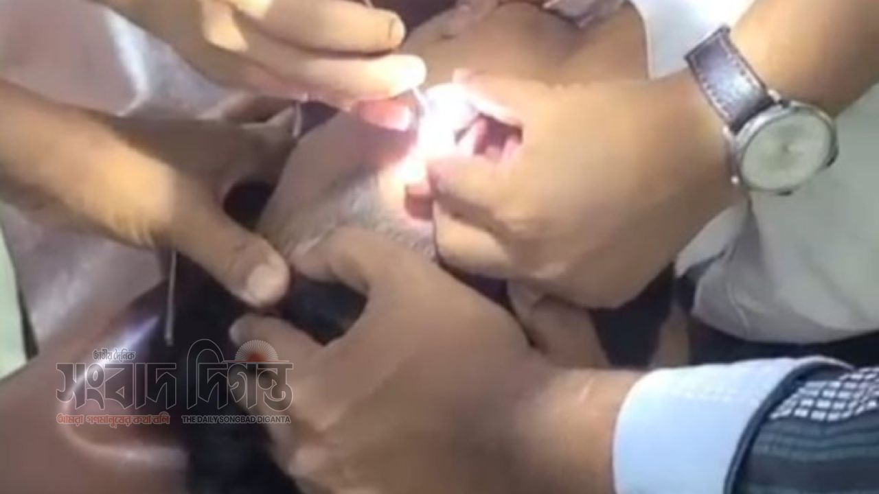 কানে মিলল দুই ইয়াবা ট্যাবলেট, মাদক লুকানোর নতুন কৌশল