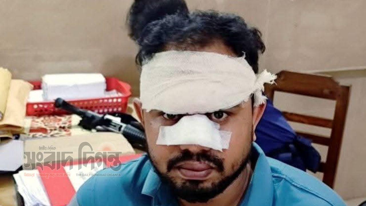 কসবায় চেকপোস্টে পুলিশের সিএনজিকে এনা পরিবহনের বাসের ধাক্কা, ৪ পুলিশ সদস্য আহত