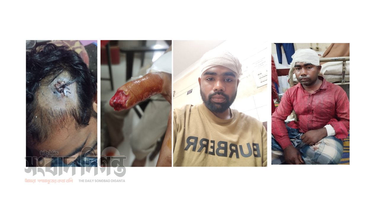 বিজয়নগরে বাঁশ কাটাকে কেন্দ্র করে দু পক্ষের সংঘর্ষে আহত ১০ 