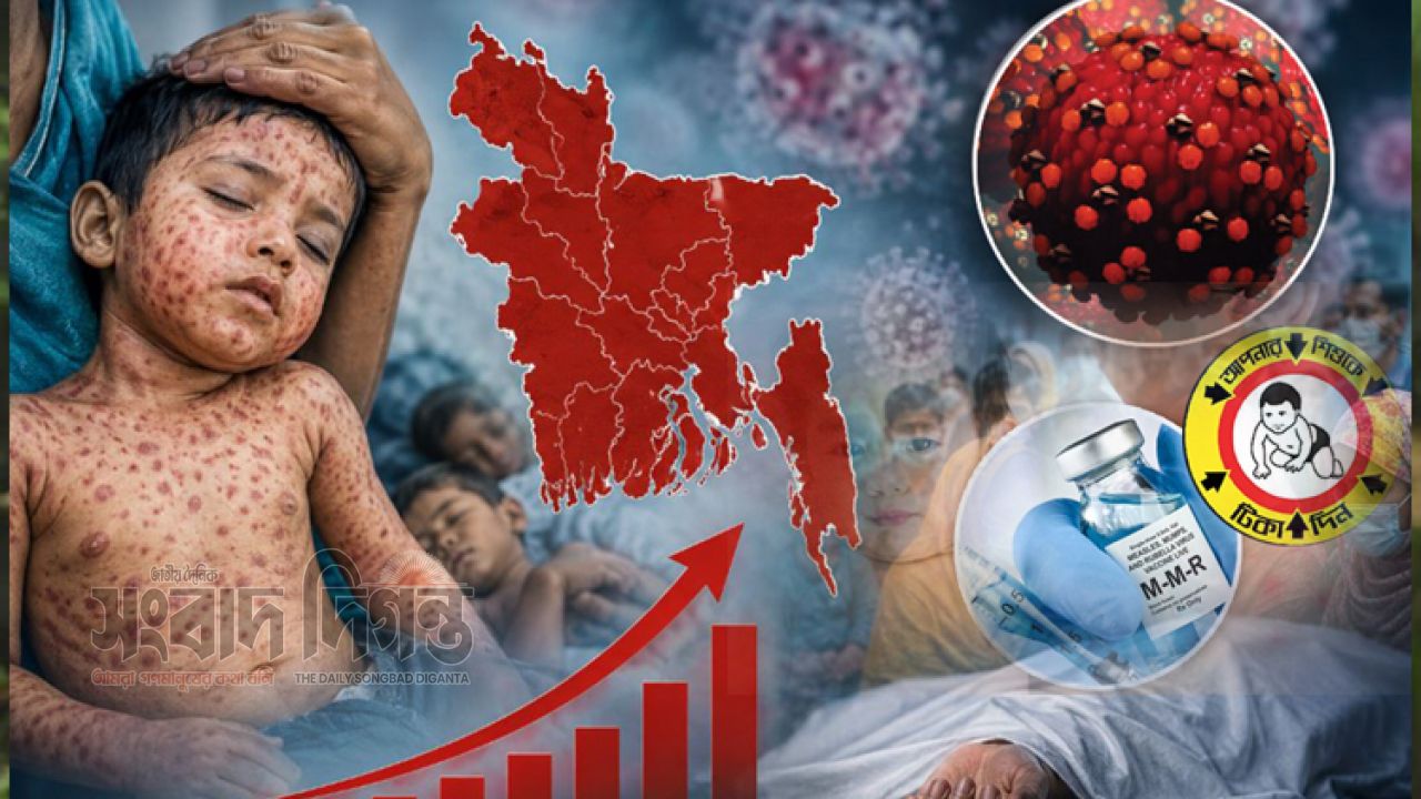 দেশে ভয়াবহ হাম পরিস্থিতি, ২৪ ঘণ্টায় আরও ৪ শিশুর মৃত্যু 