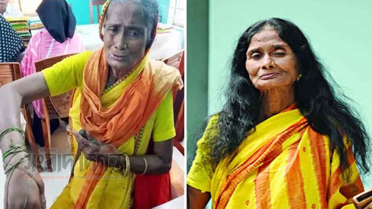 চিকিৎসা সংকটে কাঙালিনী সুফিয়া, সহায়তায় এবিজি ফাউন্ডেশন