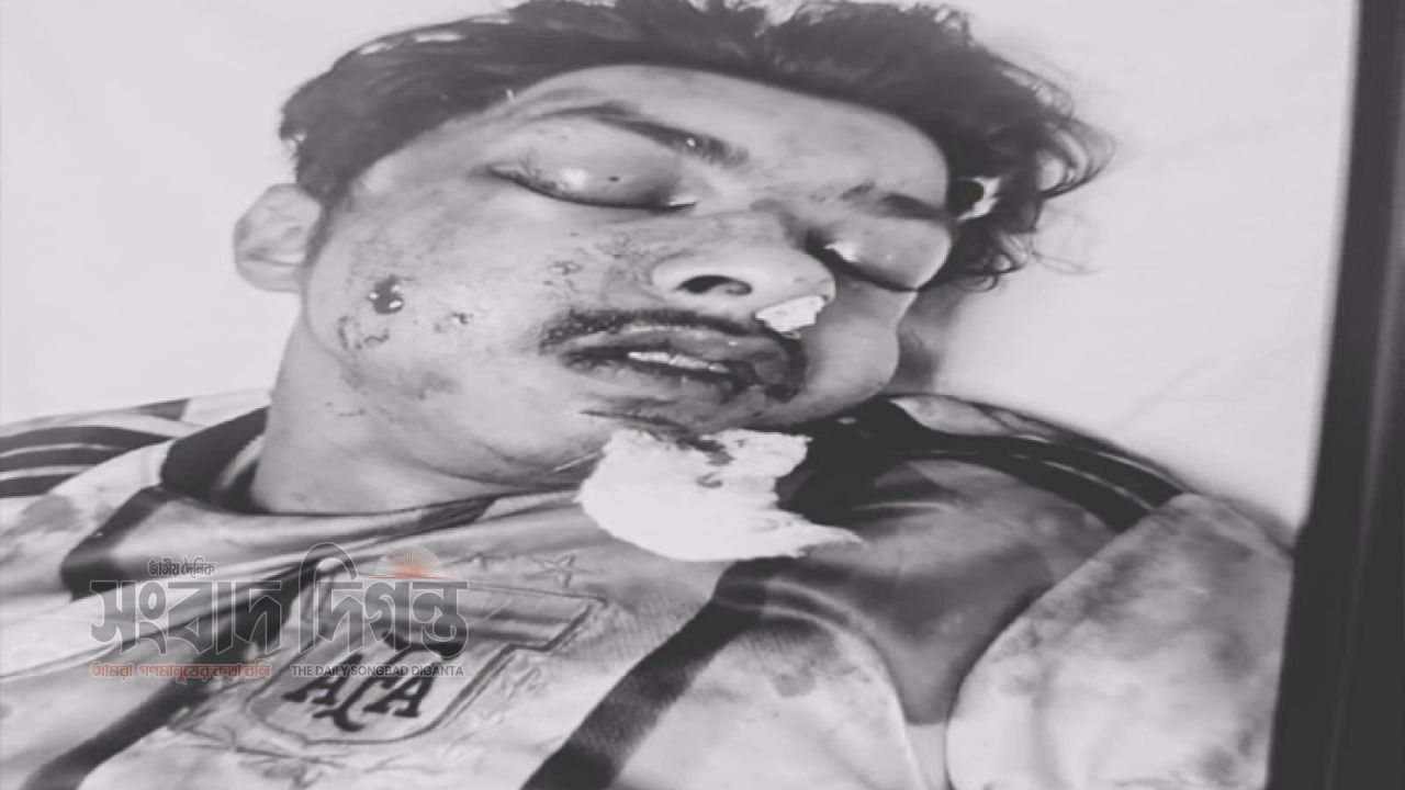 বগুড়া শেরপু‌রে পিকআপের ধাক্কায় মোটর সাইকেল আরোহীর মৃত্যু  আহত একজন 