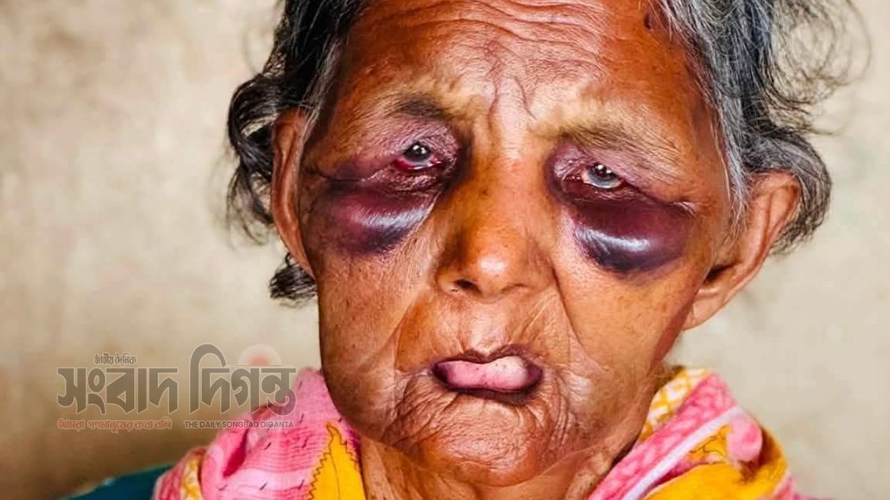 রায়পুরায় হামলার শিকার বাকপ্রতিবন্ধী পরিচ্ছন্নতা কর্মী বুবি বেগম মারা গেছেন