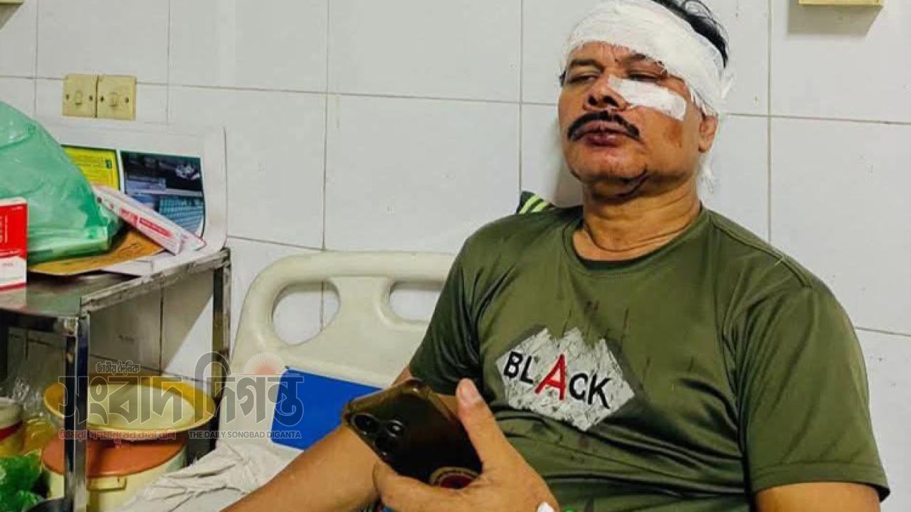 সাংবাদিক নেতা এম কাজল খানের ওপর হামলার অভিযোগ, জড়িতদের গ্রেপ্তারের দাবিতে ক্ষোভ 