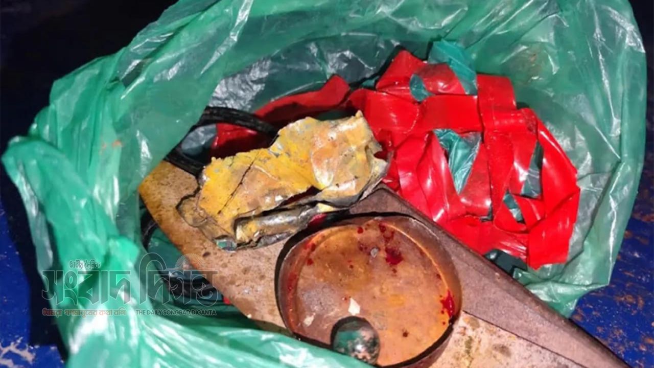 আশুলিয়ায় ককটেল তৈরির সময় বিস্ফোরণ, যুবকের হাতের আঙুল উড়ে গুরুতর আহত 