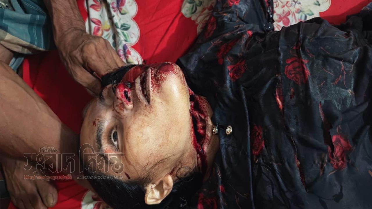 গাজীপুরে আবাসিক হোটেল থেকে নারীর রক্তাক্ত মরদেহ উদ্ধার, সঙ্গী পলাতক 