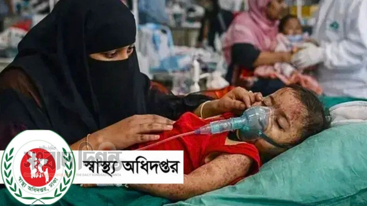 হামের উপসর্গে আরও ৭ শিশুর মৃত্যু, নতুন রোগী ১ হাজার ৩১